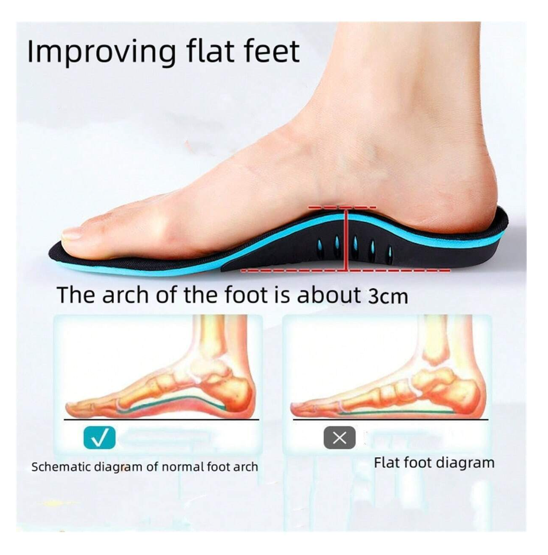 Sculpted Comfort: Orthopedic Insoles for Flat Feet and Low Arch Support - Elevate Your Every Step!