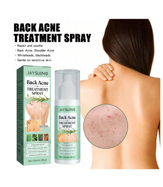 Clear Skin Confidence: Illuminate Back & Arm Acne with our Repair Spray!